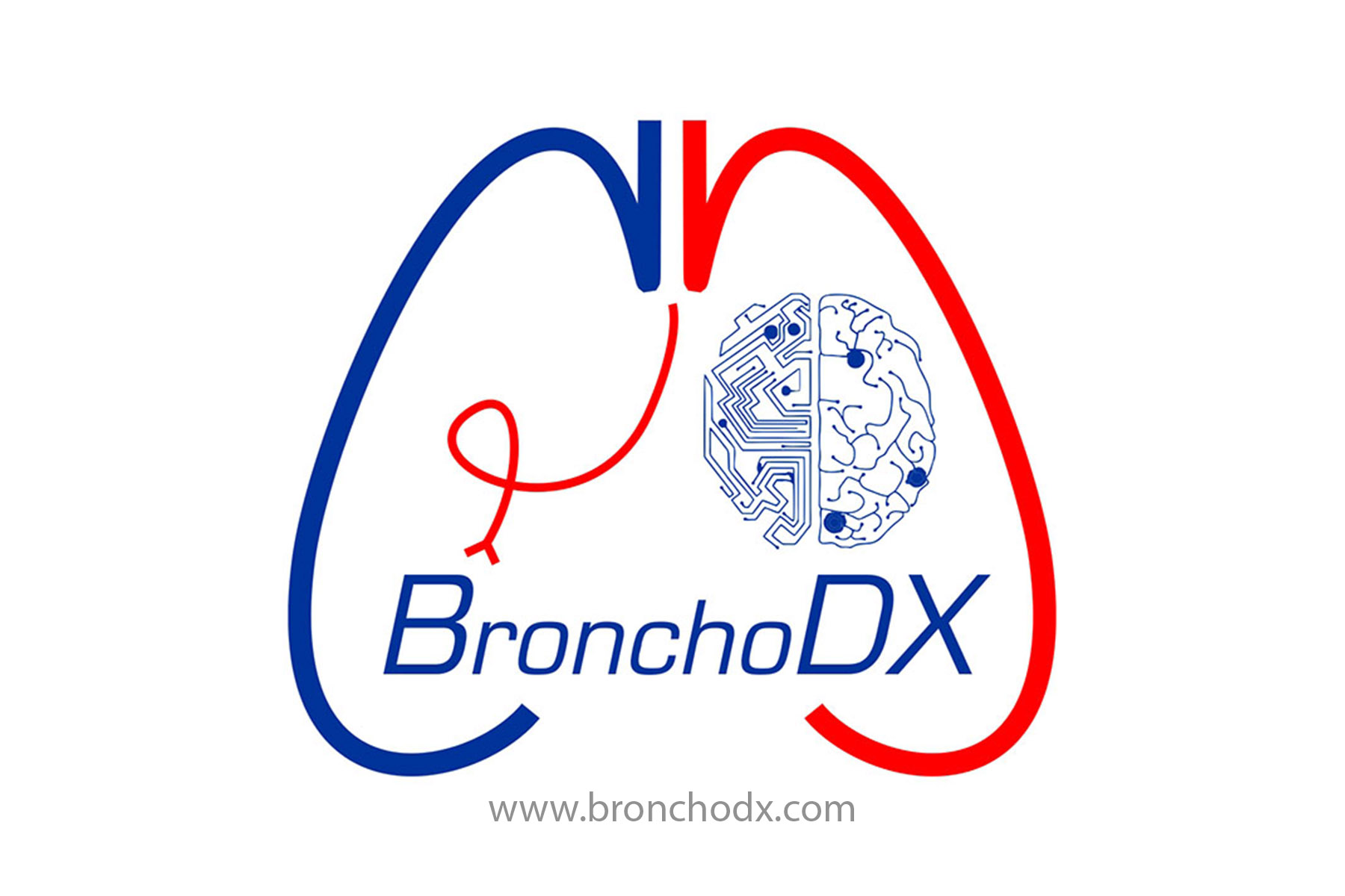 BronchoDX